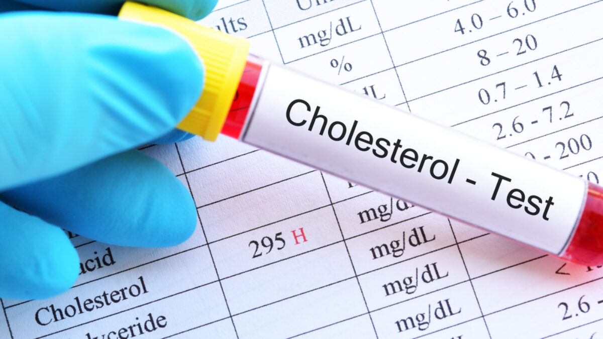 Pite to každý deň a váš cholesterol bude dokonalý. Výsledky testov prekvapia aj lekára