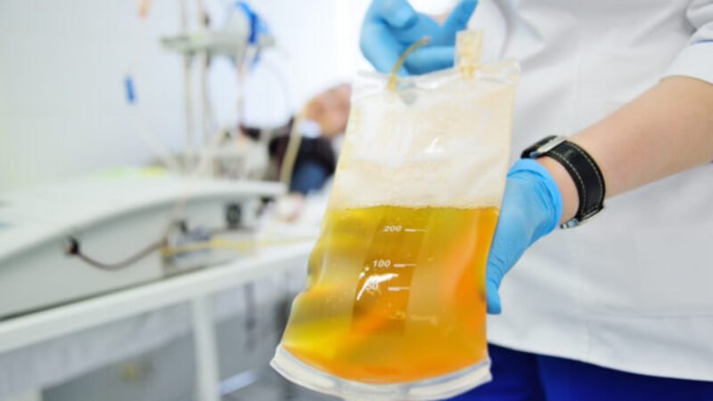 Pacienti odkázaní na lieky vyrobené z krvnej plazmy pribúdajú rýchlejšie ako počet darcov