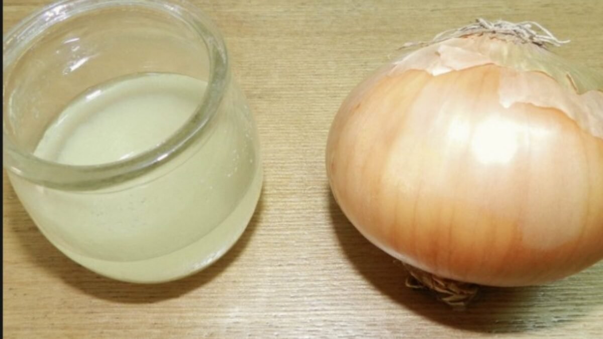 Toto je domáci recept na pigmentové škvrny: Skvelý, ľudový recept, ktorý pomohol už množstve ľudí v mojom okolí!