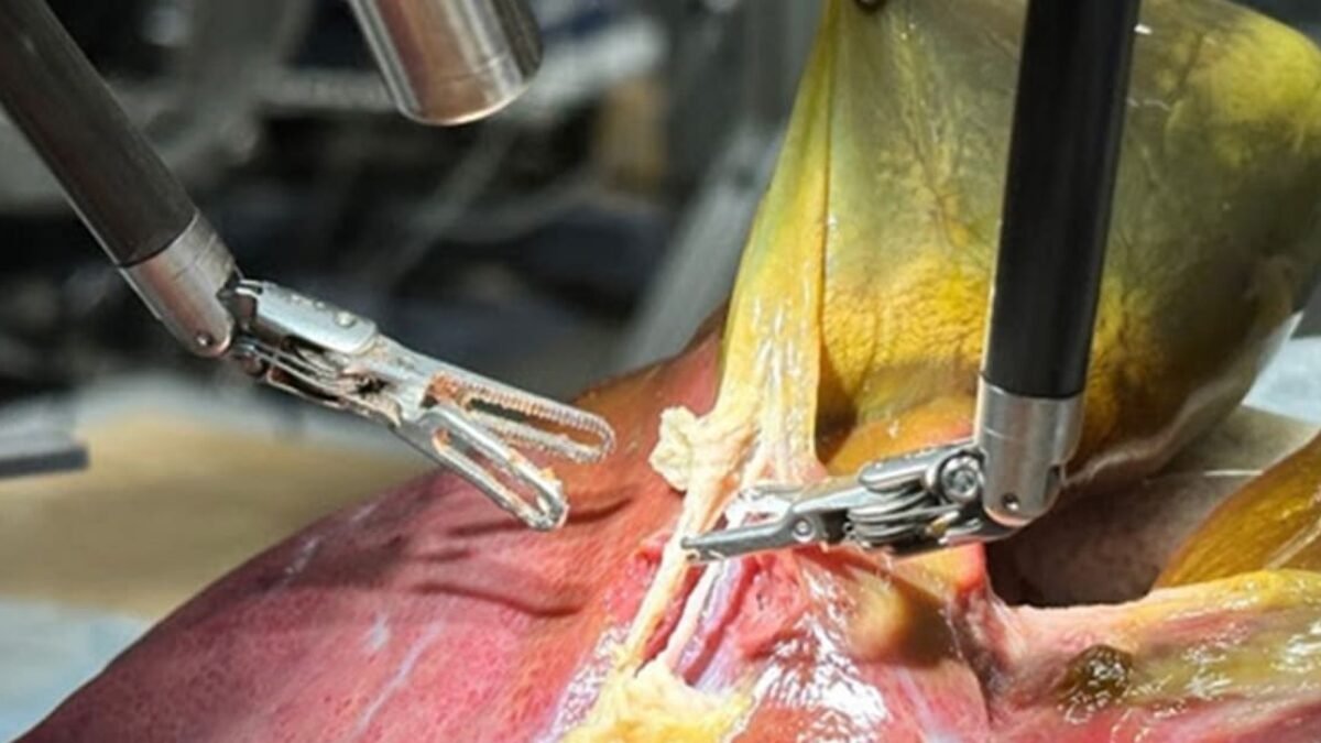 Je budúcnosť medicíny tu? Robot prvýkrát zvládol chirurgický zákrok s hovorenými pokynmi