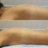 MERIÁNOVA TERAPIA