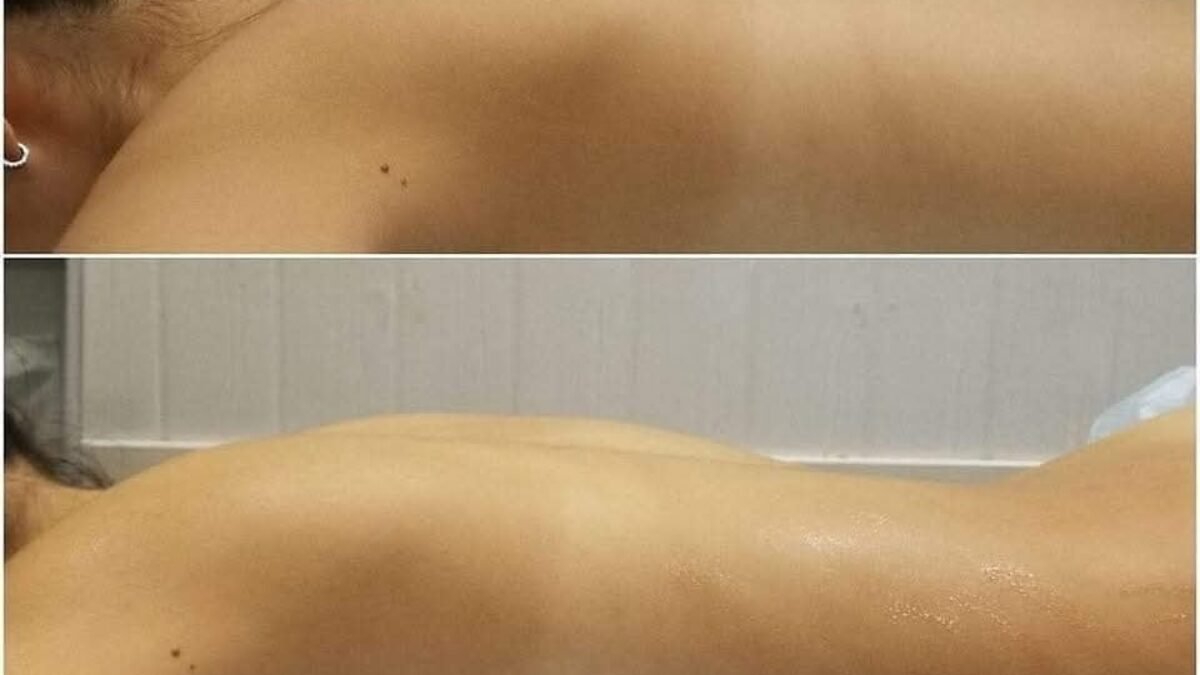 MERIÁNOVA TERAPIA
