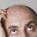 Nový lék na plešatění? Experimenty na myších odhalily běžnou látku, která může zachránit mnoho mužů