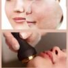 POPRASKANÉ KRVNÉ CIEVY – ROSACEA – „PAVÚČIE CIEVKY“