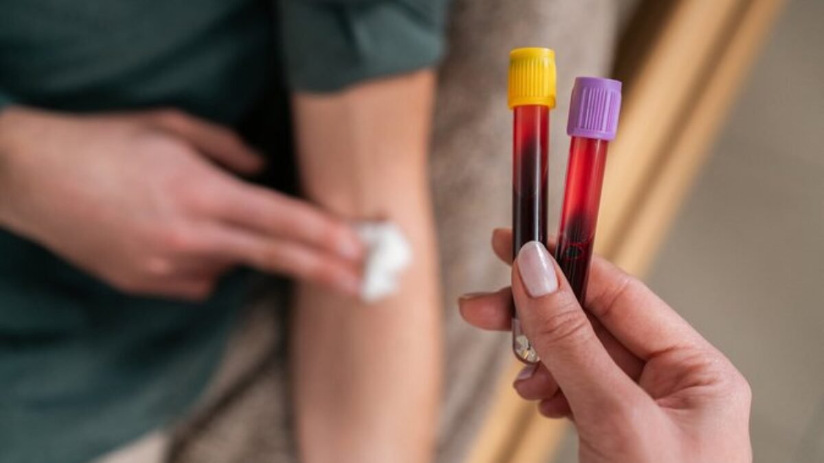 Strážte si hladinu homocysteínu: Zistíte z nej, že telo nefunguje dobre