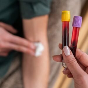 Strážte si hladinu homocysteínu: Zistíte z nej, že telo nefunguje dobre