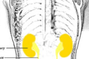 Časté močenie – prečo trápi práve vás a ako sa ho zbaviť?