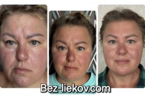 ÚŽASNÉ VÝSLEDKY po terapiách s naším prístrojom