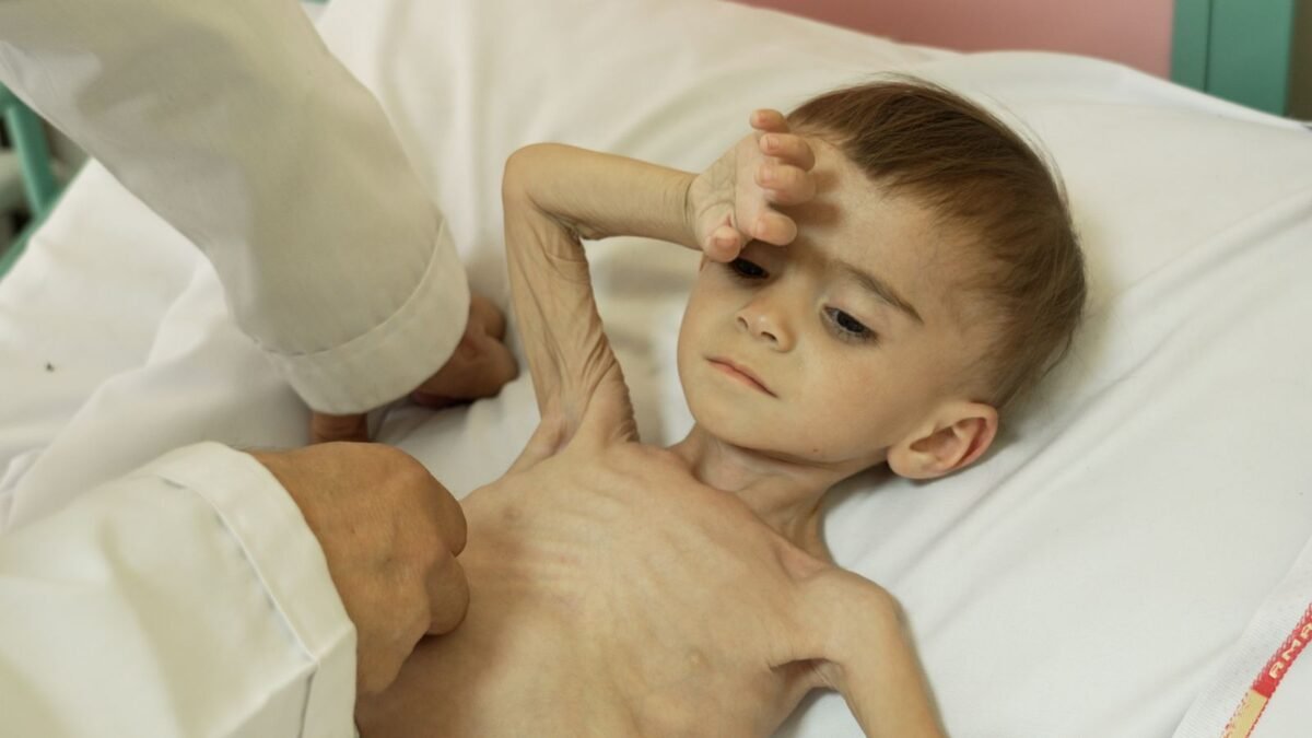 Afganistan: Plačúce deti oslabené hladom zapĺňajú afganskú nemocnicu – rodičia sa obávajú, že každý deň môže byť ich posledný