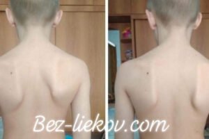 AJ DETI môžu absolvovať našu meridiánovu terapiu podľa TRADIČNEJ ČÍNSKEJ MEDICÍN...